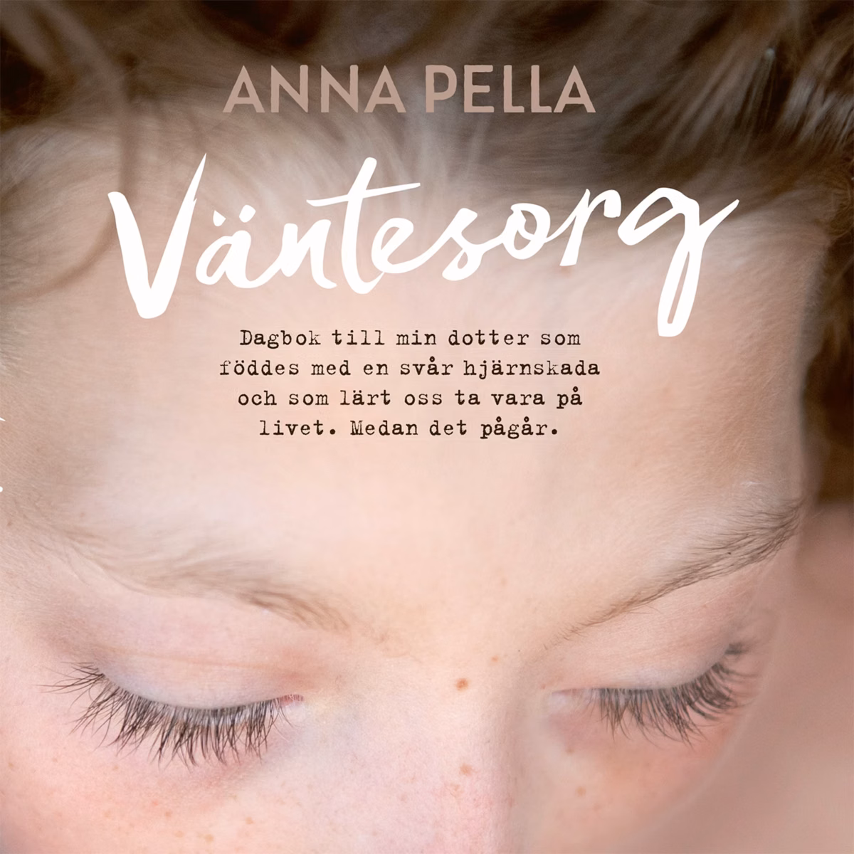 Väntesorg